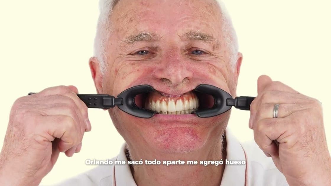 Prótesis sobre implantes