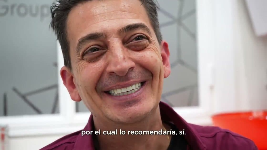 Recuperación de la sonrisa con prótesis