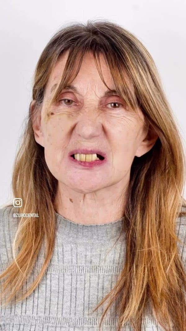 Lo que dicen nuestros pacientes